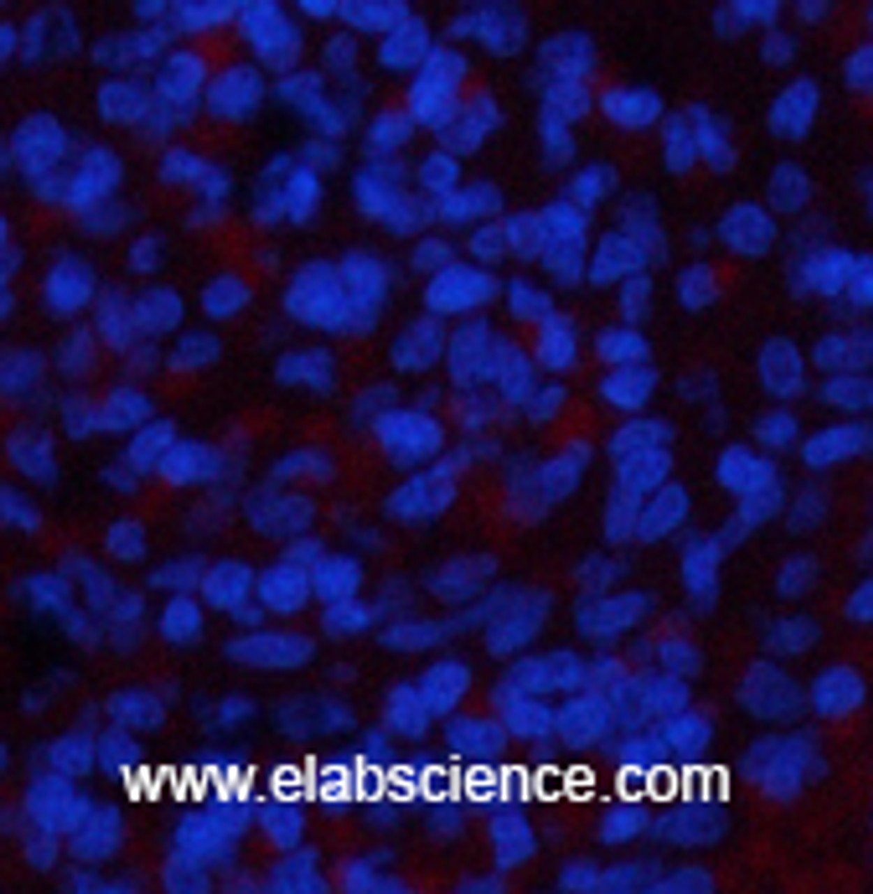Immunofluorescence analysis of Rat spleen tissue using NBR1 Monoclonal Antibody at dilution of 1:200.