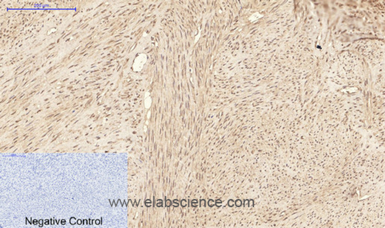 Immunohistochemistry of paraffin-embedded Human uterus tissue using ATG7 Monoclonal Antibody at dilution of 1:200.