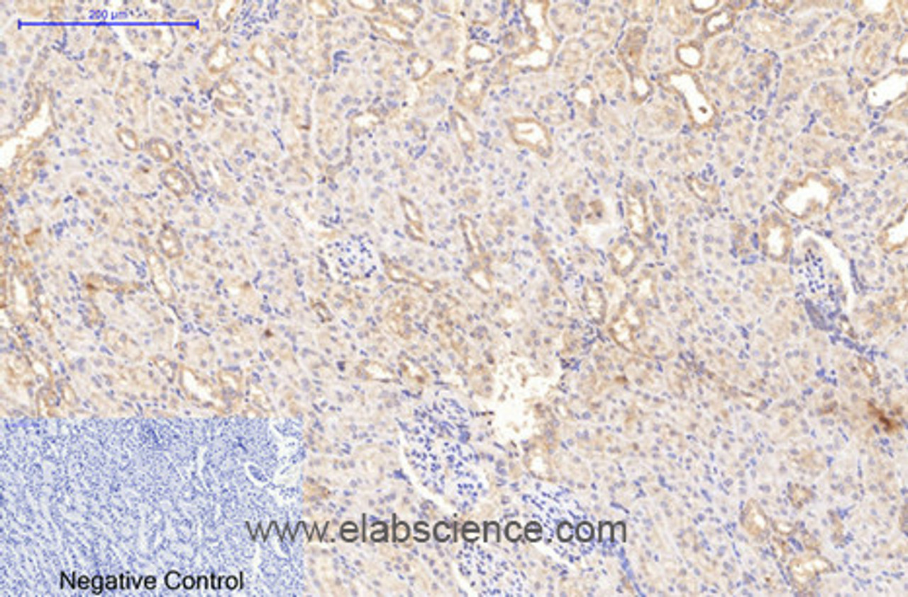 Immunohistochemistry of paraffin-embedded Rat kidney tissue using COL1A1 Monoclonal Antibody at dilution of 1:200.