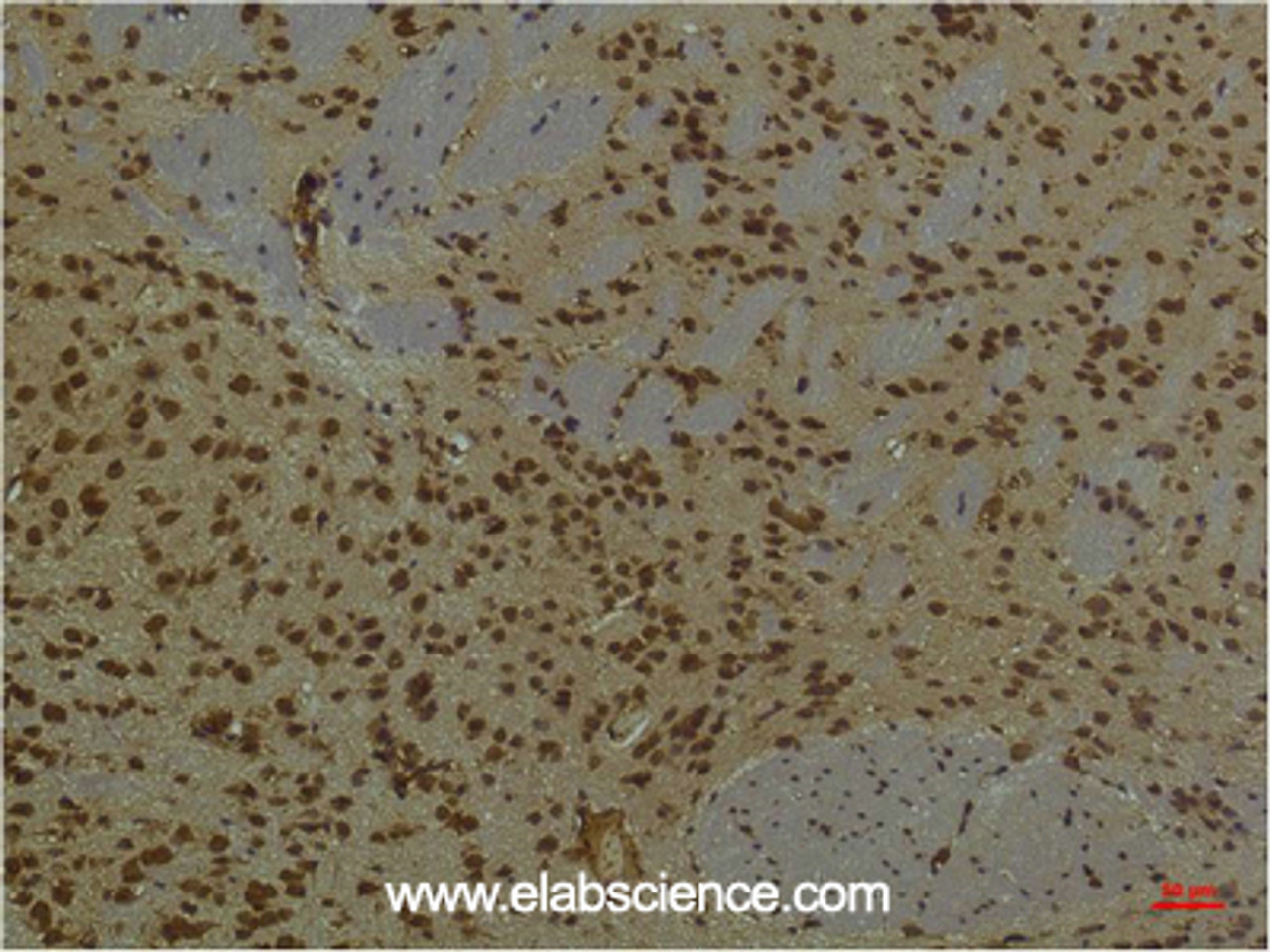 Immunohistochemistry of paraffin-embedded Mouse brain tissue using PI 3 kinase p85 alpha Monoclonal Antibody at dilution of 1:200.