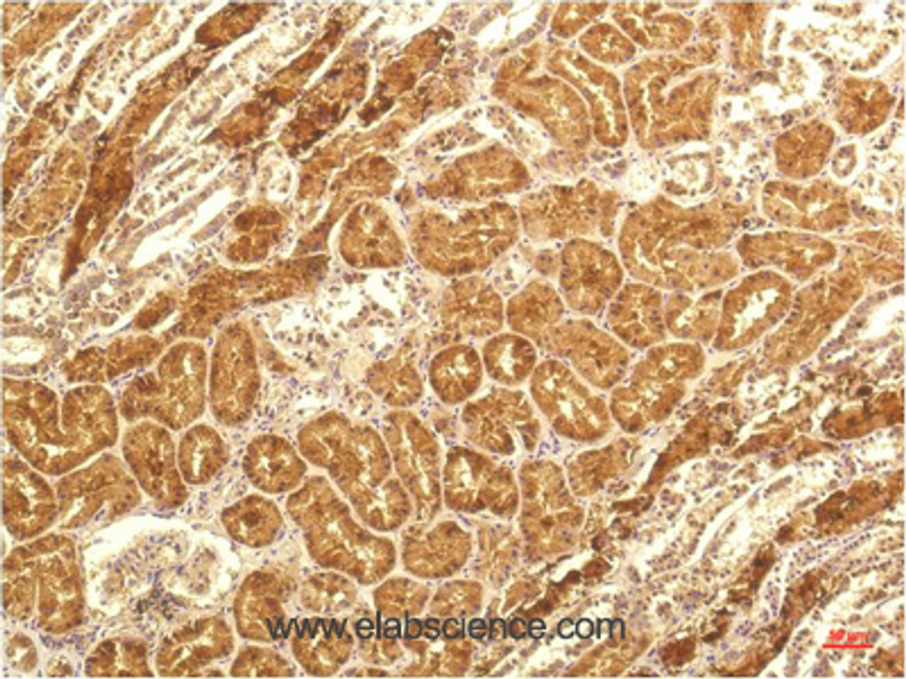 Immunohistochemistry of paraffin-embedded Human kidney tissue using IL8 Monoclonal Antibody at dilution of 1:200.