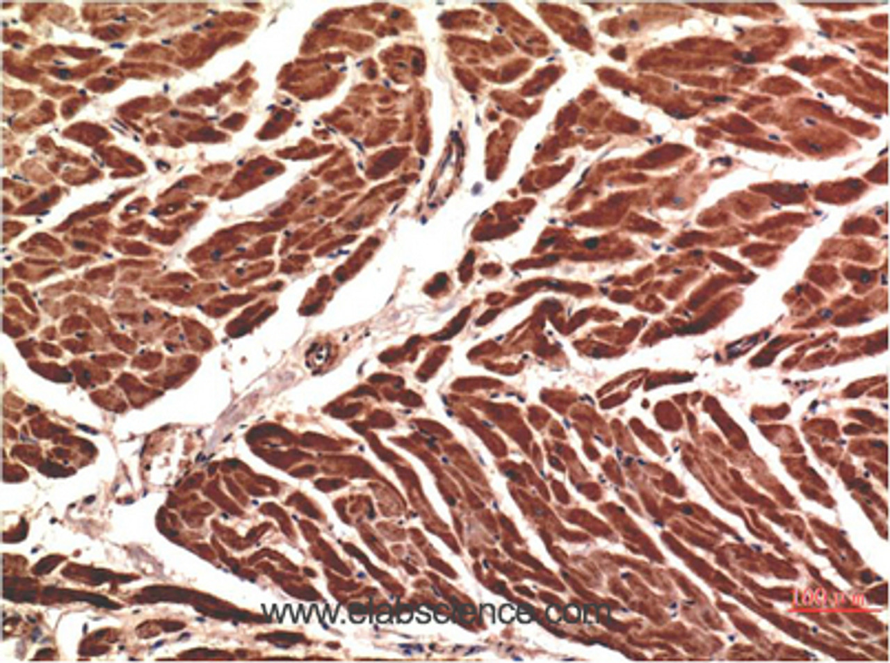 Immunohistochemistry of paraffin-embedded Human heart tissue using VE-Cadherin Monoclonal Antibody at dilution of 1:200.