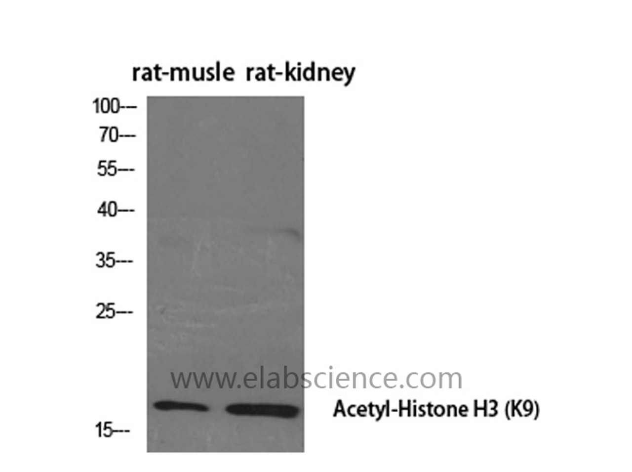 Western Blot analysis of  Rat muscle, kindey using Acetyl-Histone H3 (Lys9) Polyclonal Antibody at dilution of 1:2000.