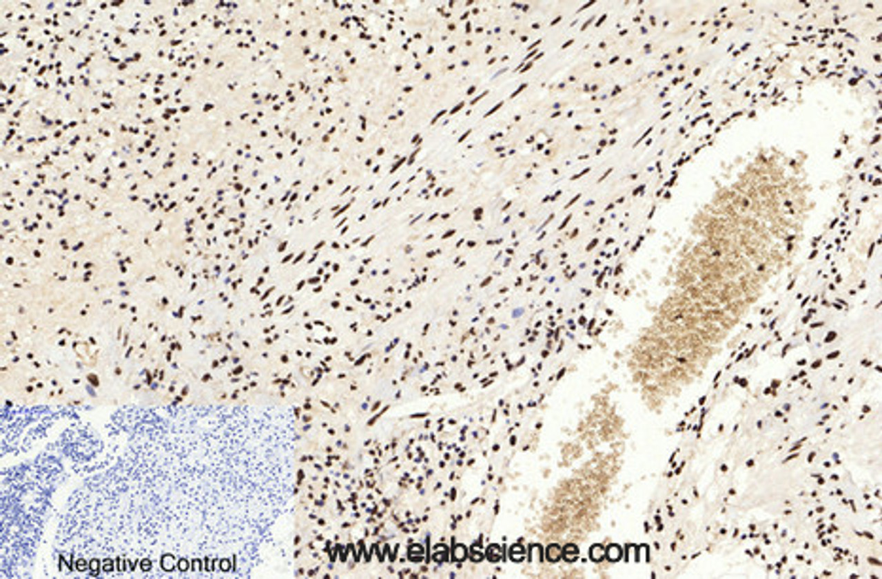 Immunohistochemistry of paraffin-embedded Human appendix tissue using Acetyl-Histone H3 (Lys9) Polyclonal Antibody at dilution of 1:200.