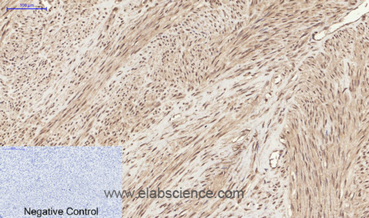 Immunohistochemistry of paraffin-embedded Human uterus tissue  using Phospho-CHEK2 (Thr68) Polyclonal Antibody at dilution of 1:200