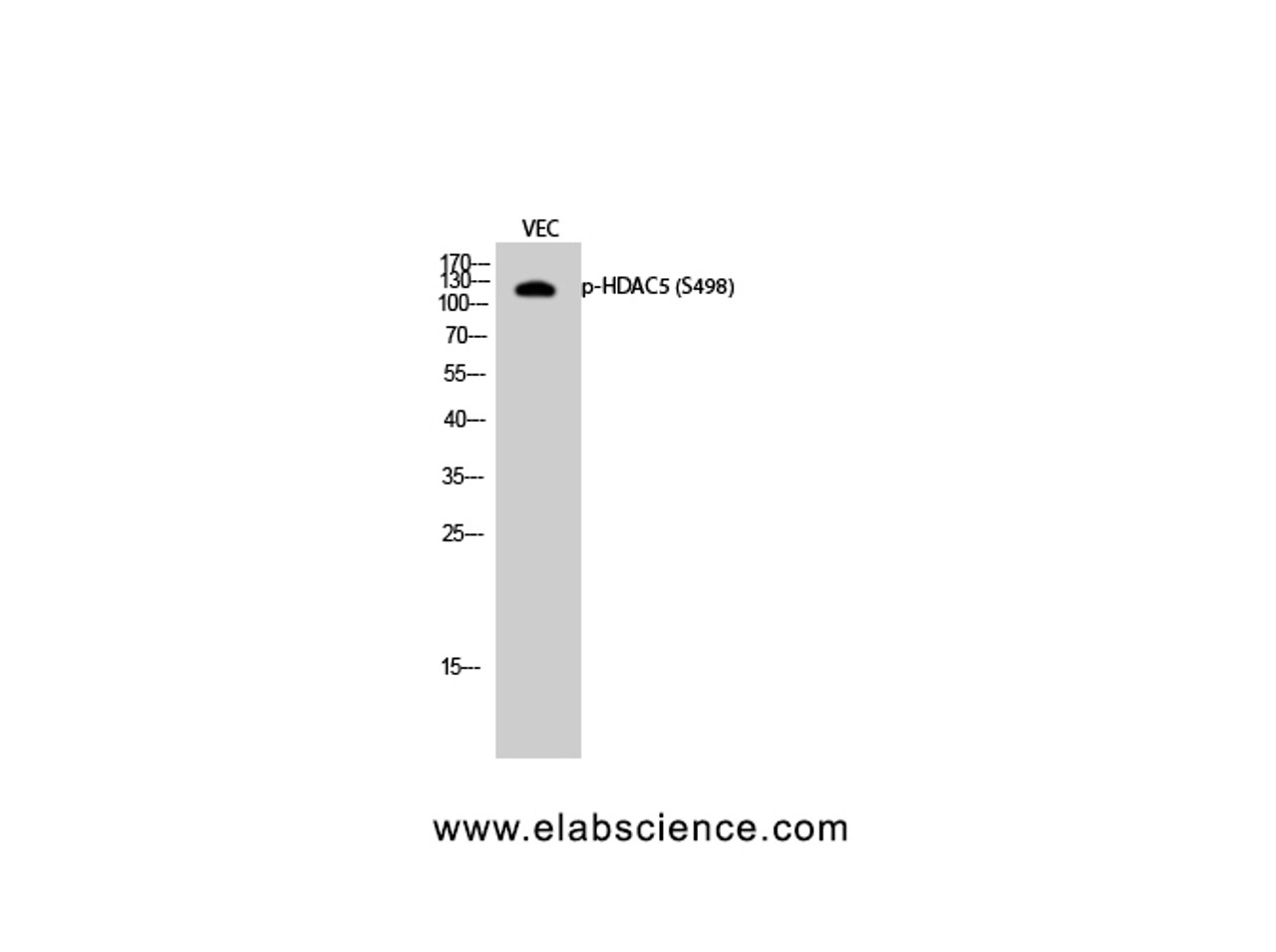 Western Blot analysis of VEC cells with Phospho-HDAC5 (Ser498) Polyclonal Antibody at dilution of 1:500