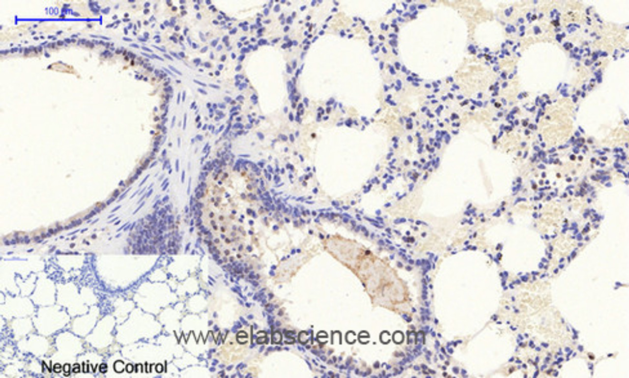 Immunohistochemistry of paraffin-embedded Rat lung tissue with Phospho-Stat1 (Tyr701) Polyclonal Antibody at dilution of 1:200
