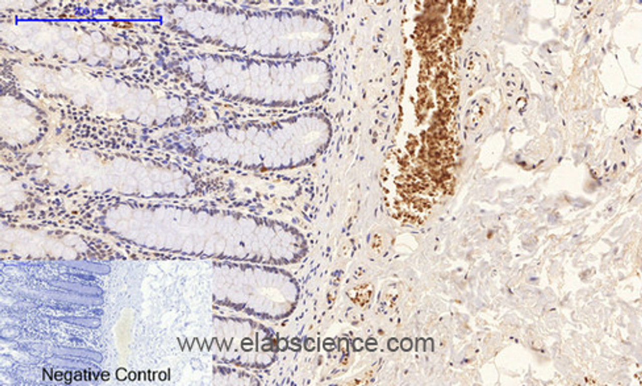 Immunohistochemistry of paraffin-embedded Human colon tissue with Phospho-p38 (Thr180/Tyr182) Polyclonal Antibody at dilution of 1:200