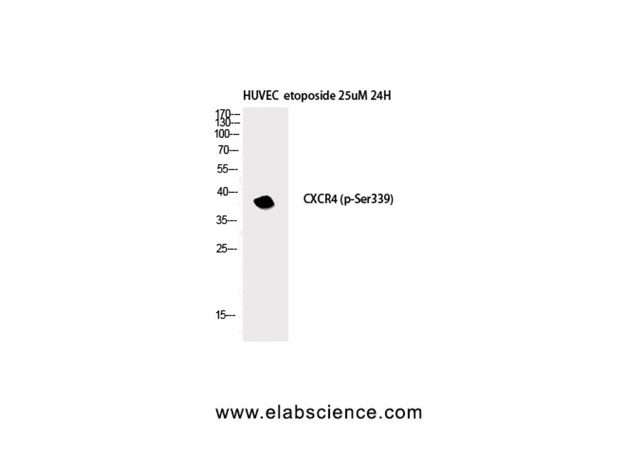 Western Blot analysis of HuvEc etoposide 25uM 24h cells with Phospho-CXCR4 (Ser339) Polyclonal Antibody