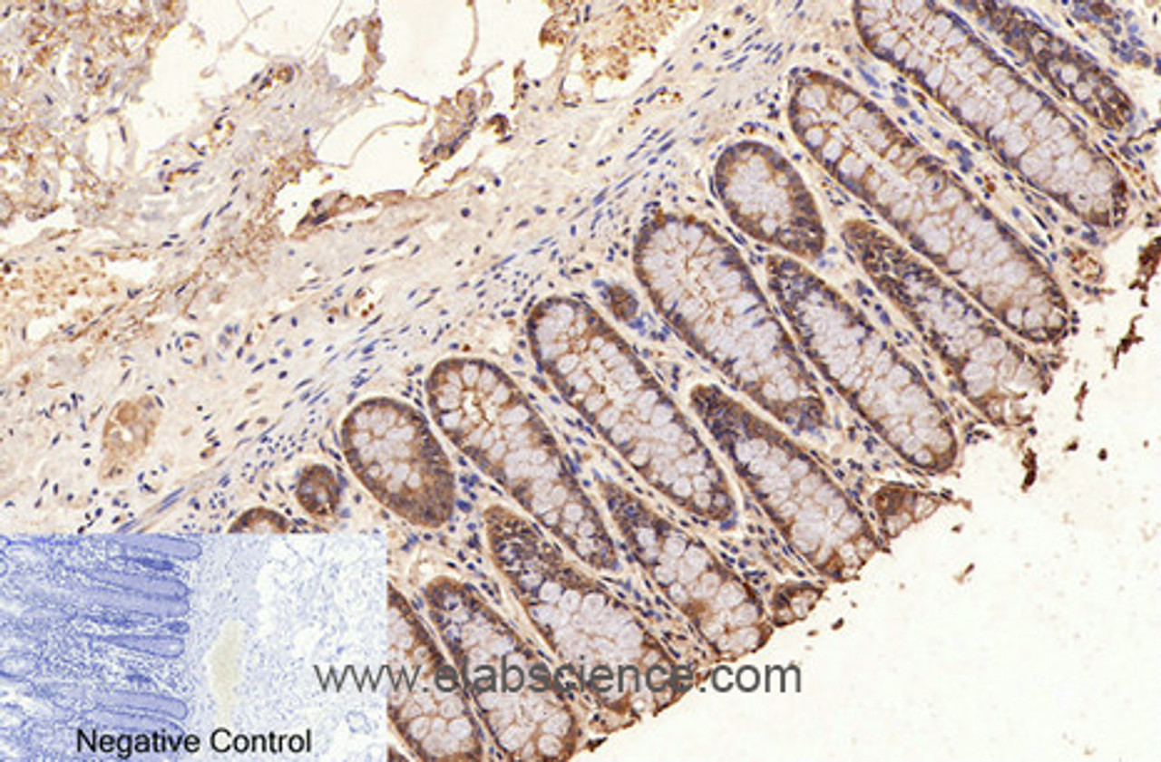 Immunohistochemistry of paraffin-embedded Human colon tissue using GAPDH Monoclonal Antibody at dilution of 1:200.