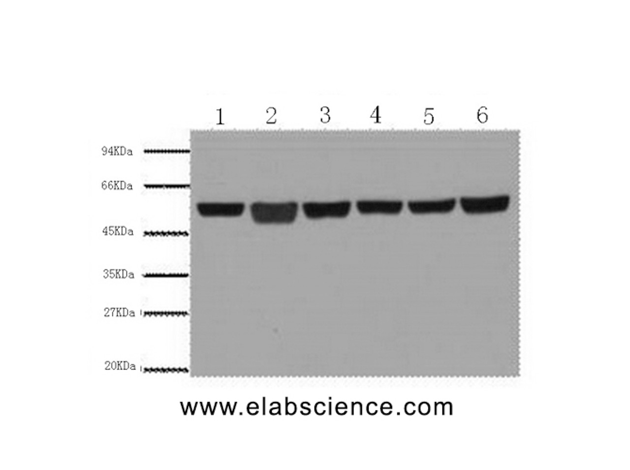 Western Blot analysis of A549, Rat brain, Mouse brain, Chicken lung, Rabbit testis, Sheep muscle using beta Tubulin Monoclonal Antibody at dilution of 1:5000.