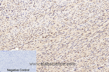 Immunohistochemistry of paraffin-embedded Human uterus tissue using Lamin B1 Monoclonal Antibody at dilution of 1:200.