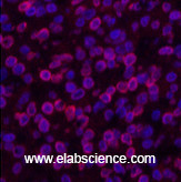 Immunofluorescence analysis of Human lung cancer tissue using Lamin B1 Monoclonal Antibody at dilution of 1:200.