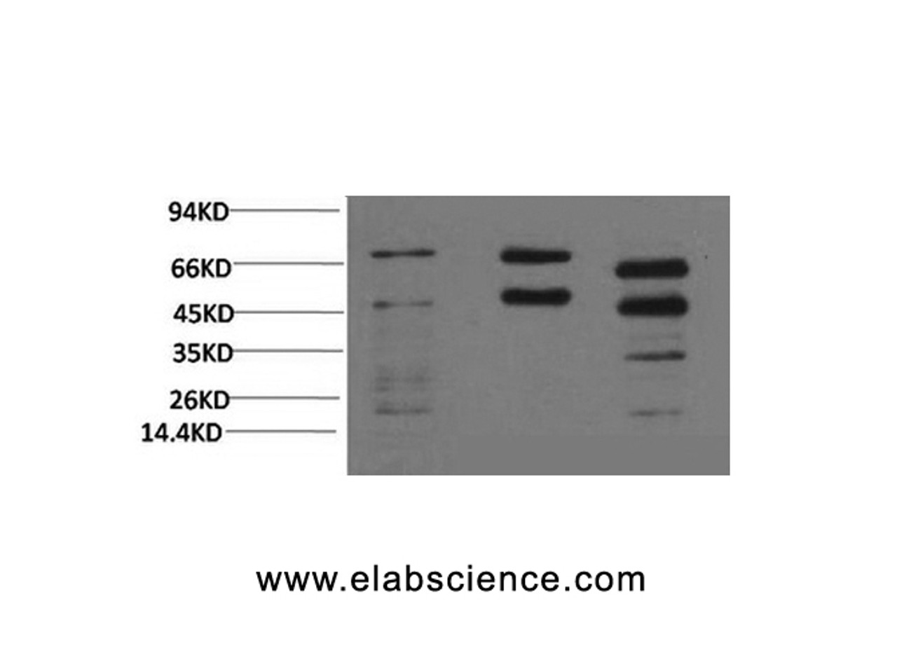 Western Blot analysis of 1) Hela, 2) Rat brain, 3) Mouse brain with Phosphoserine Monoclonal Antibody at dilution of 1:2000