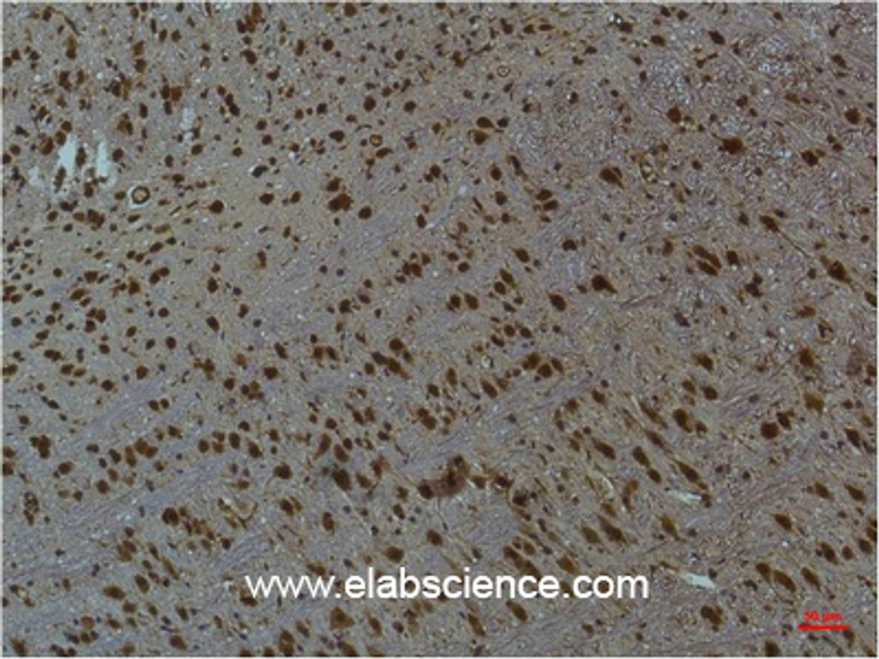 Immunohistochemistry of paraffin-embedded Mouse brain tissue using Phospho-CAMK2 beta/gamma/delta (Thr287) Monoclonal Antibody at dilution of 1:200