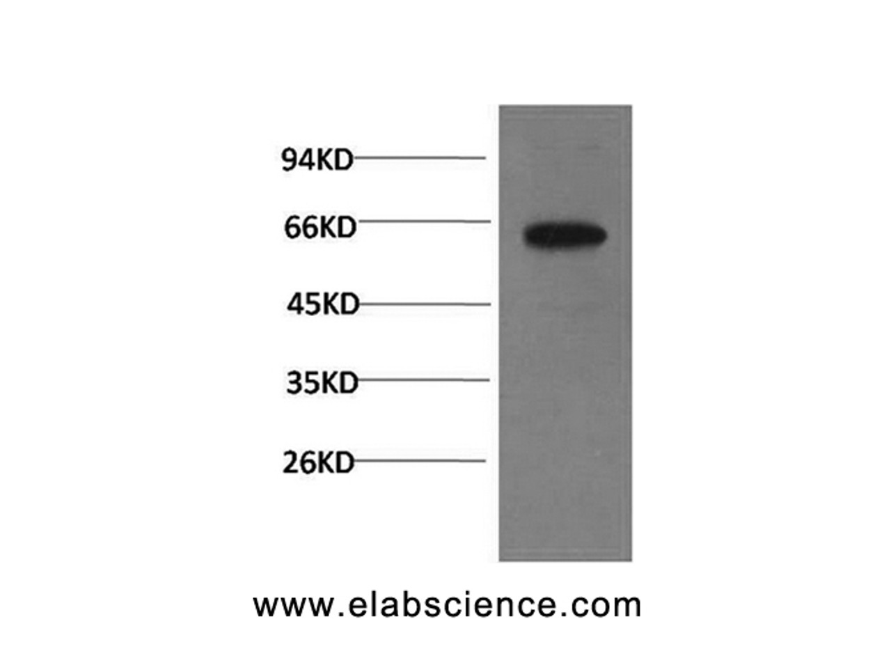 Western Blot analysis of PC-3 cells using Phospho-AKT1 (Ser473) Monoclonal Antibody at dilution of 1:1000