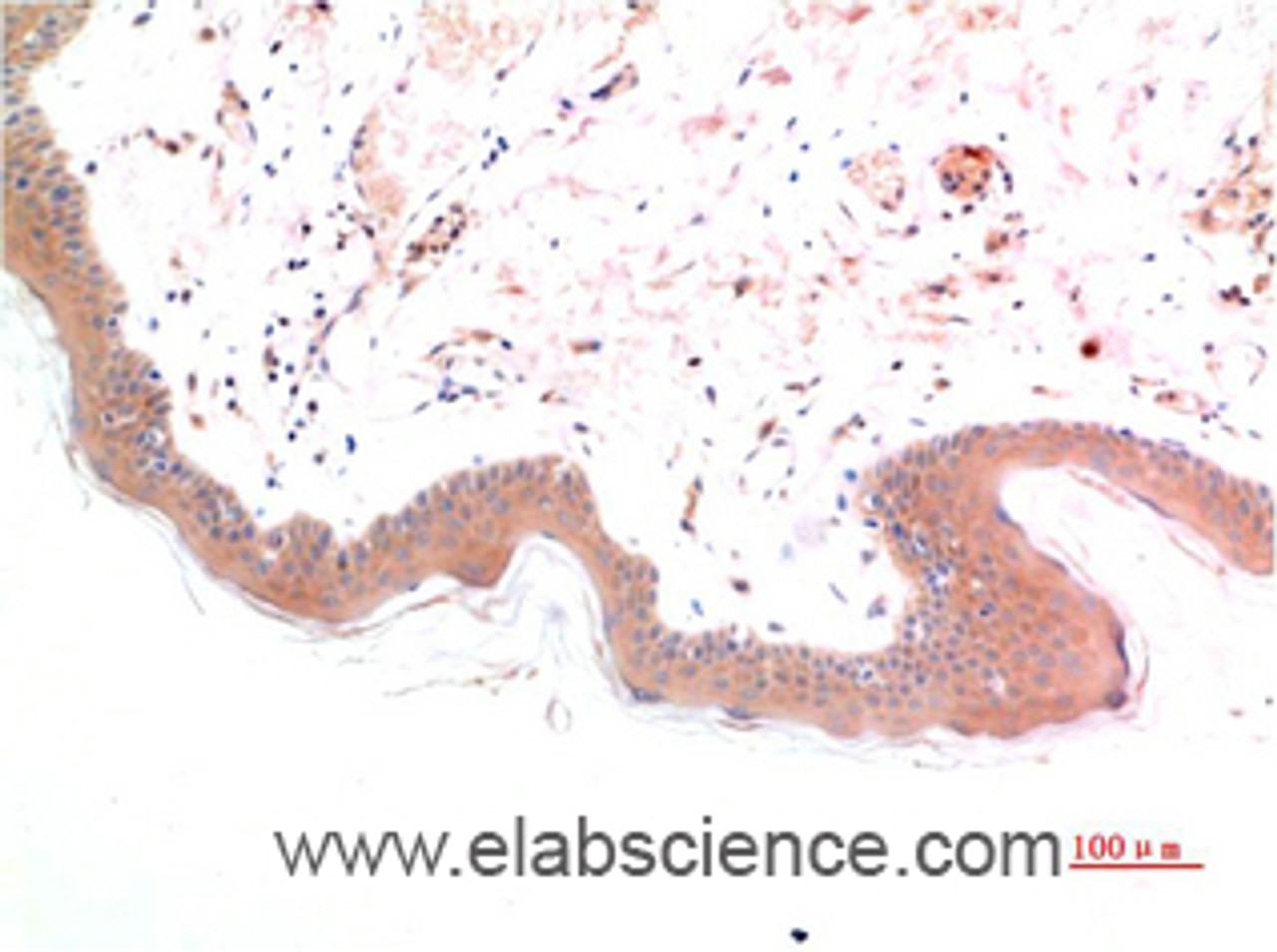 Immunohistochemistry of paraffin-embedded Human skin tissue using Phospho-SMAD3 (Ser425) Monoclonal Antibody at dilution of 1:200