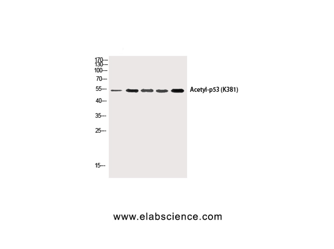 Western Blot analysis of HepG2, 293T-UV, Hela, AD293T, Hela-UV cells using p53 (Acetyl Lys381) Polyclonal Antibody at dilution of 1:1000.