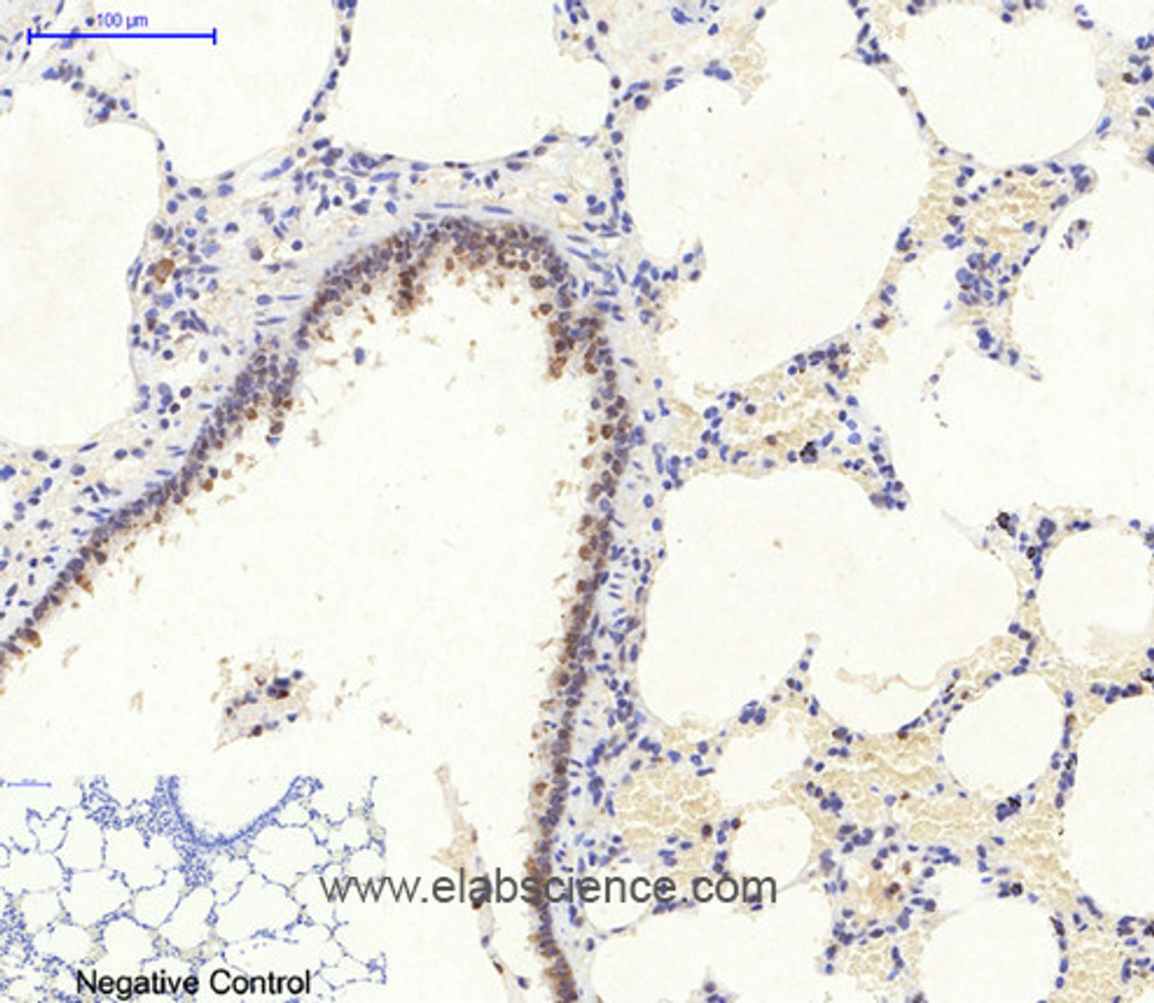 Immunohistochemistry of paraffin-embedded Rat lung tissue using AMPK alpha1/2 Polyclonal Antibody at dilution of 1:200.
