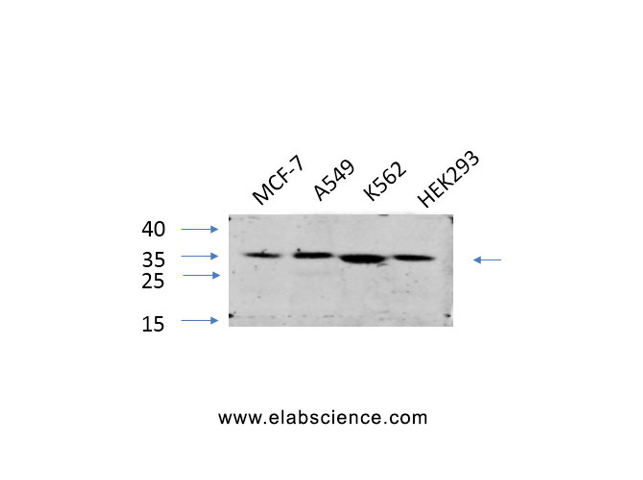 Western Blot analysis of various cells using EIF2 alpha Polyclonal Antibody at dilution of 1:1000.