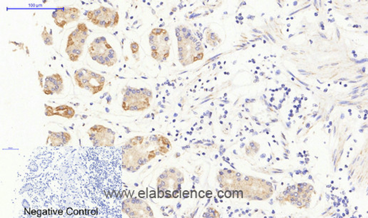 Immunohistochemistry of paraffin-embedded Human stomach tissue using JAK3 Polyclonal Antibody at dilution of 1:200.