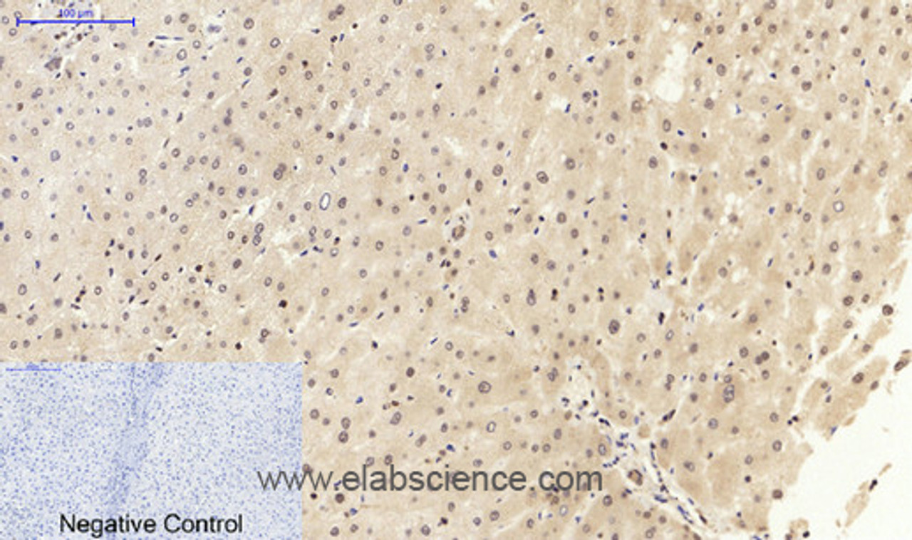 Immunohistochemistry of paraffin-embedded Human liver tissue using NFκB-p105/p50 Polyclonal Antibody at dilution of 1:200.