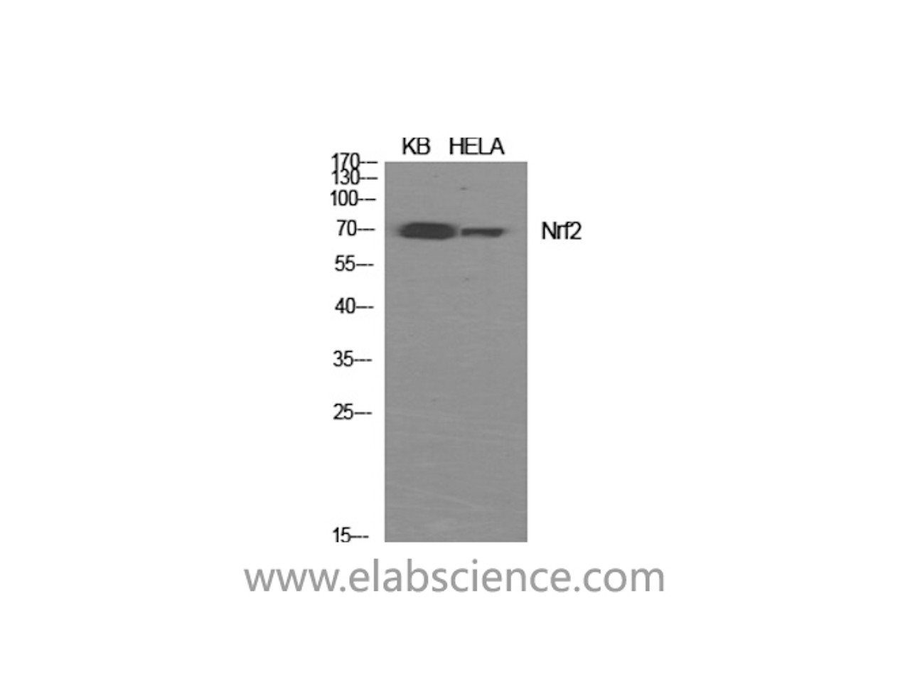 Western Blot analysis of KB, Hela cells using Nrf2 Polyclonal Antibody at dilution of 1:1000.