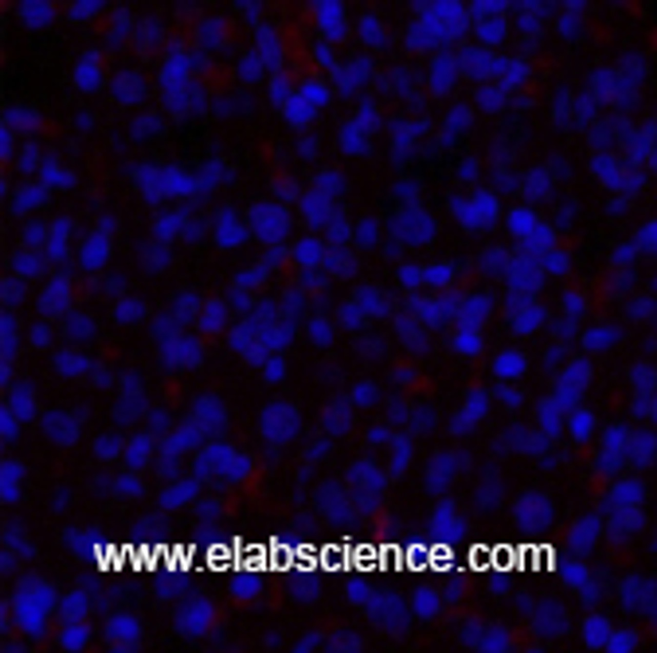 Immunofluorescence analysis of Rat lung tissue using PDPK1 Polyclonal Antibody at dilution of 1:200.