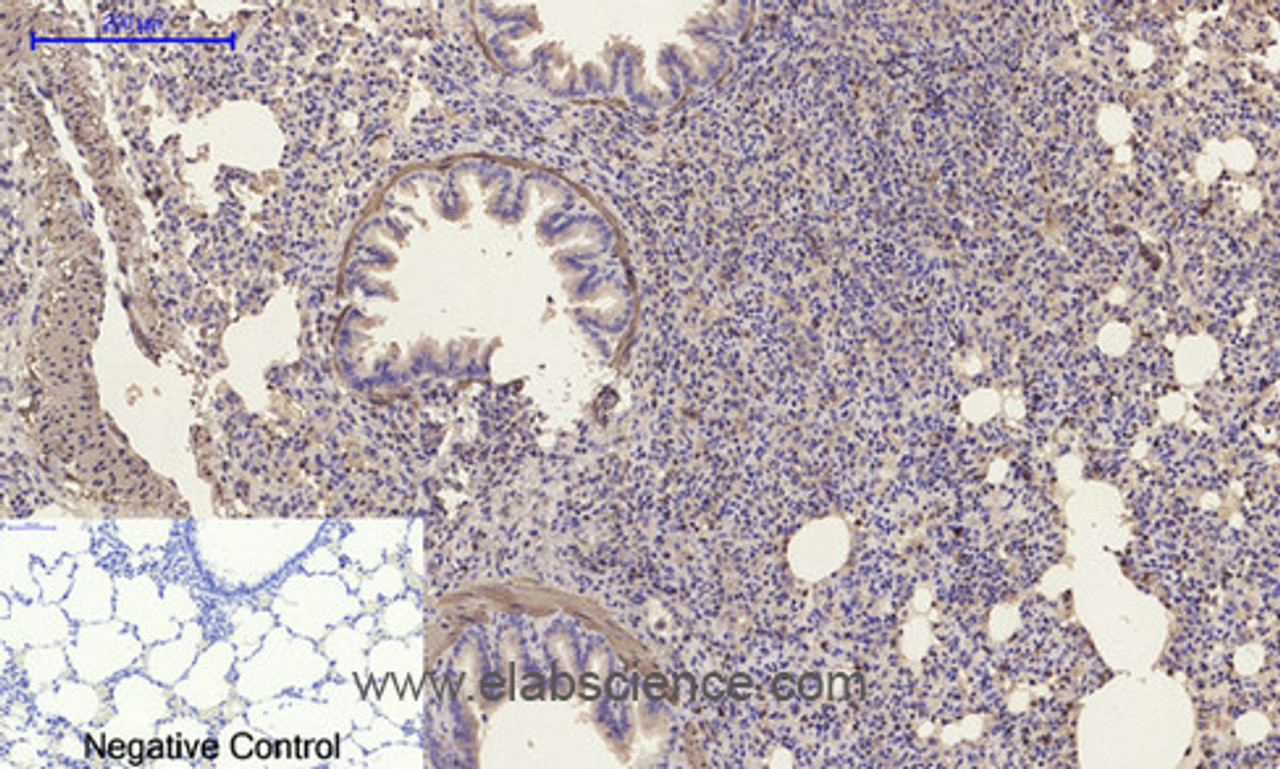 Immunohistochemistry of paraffin-embedded Rat lung tissue using α-SMA Polyclonal Antibody at dilution of 1:200.