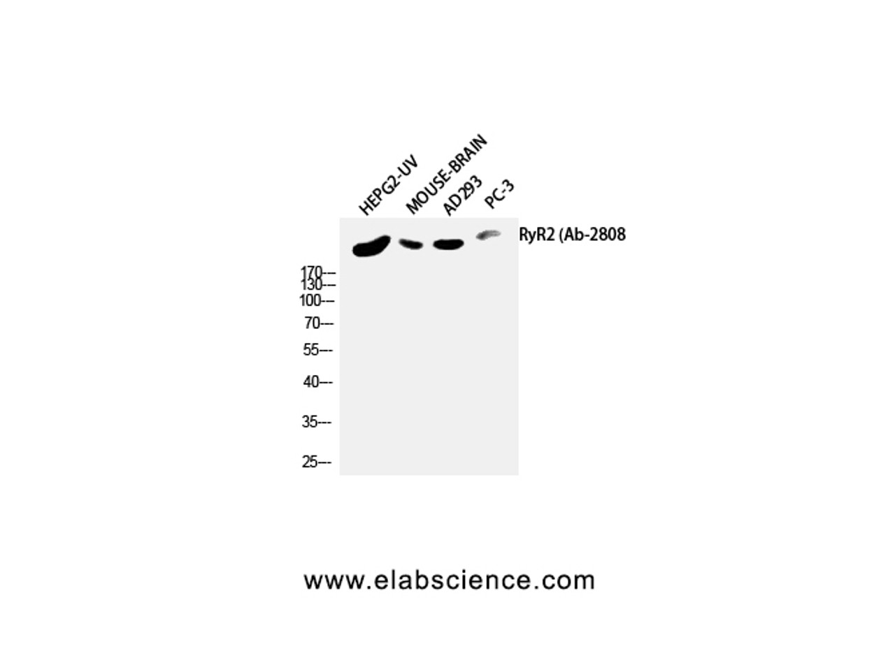 Western Blot analysis of HepG2-UV, Mouse brain, AD293T, PC-3 using RYR2 Polyclonal Antibody at dilution of 1:2000.