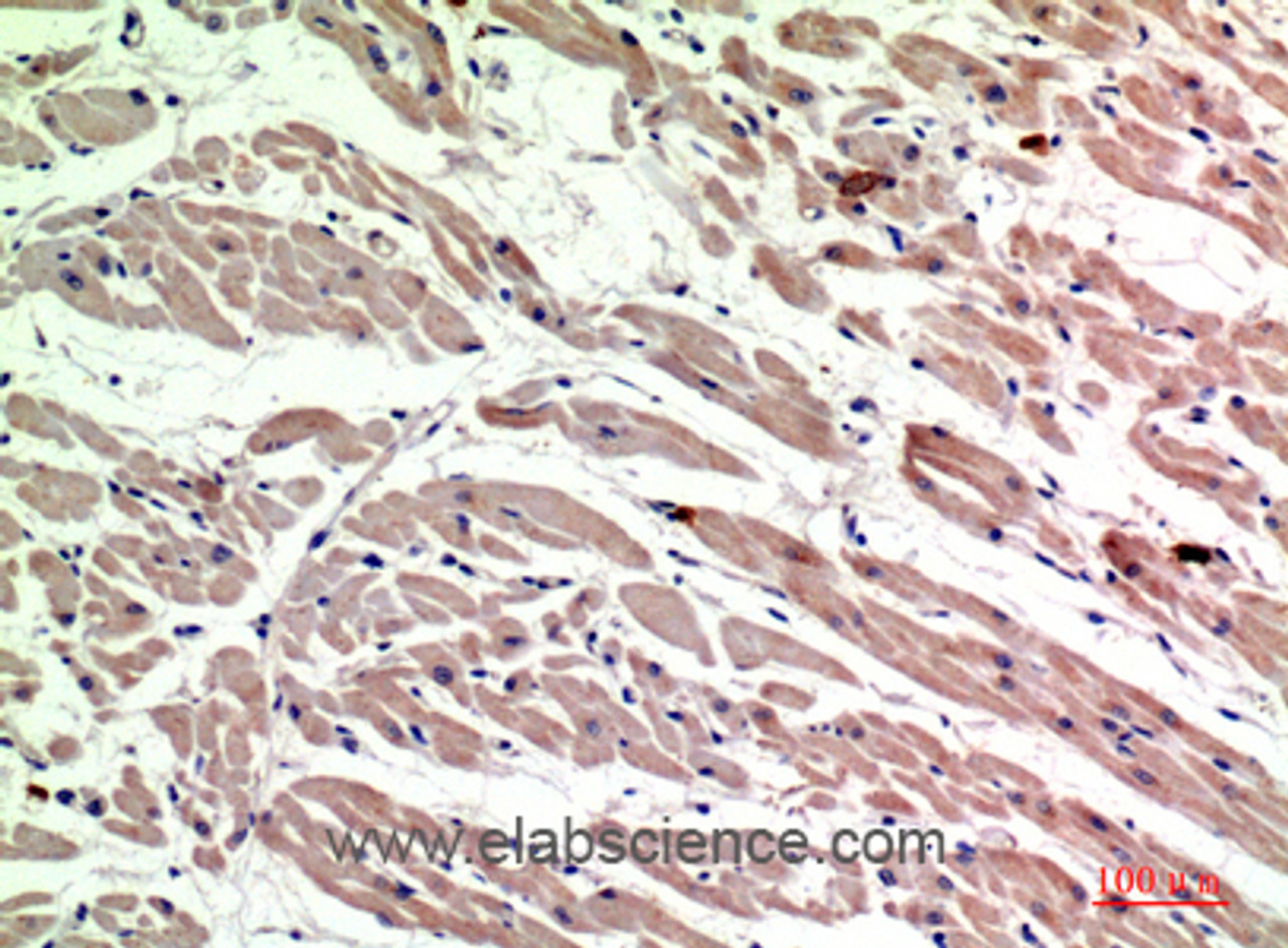 Immunohistochemistry of paraffin-embedded Human heart tissue using CD206 Polyclonal Antibody at dilution of 1:200.