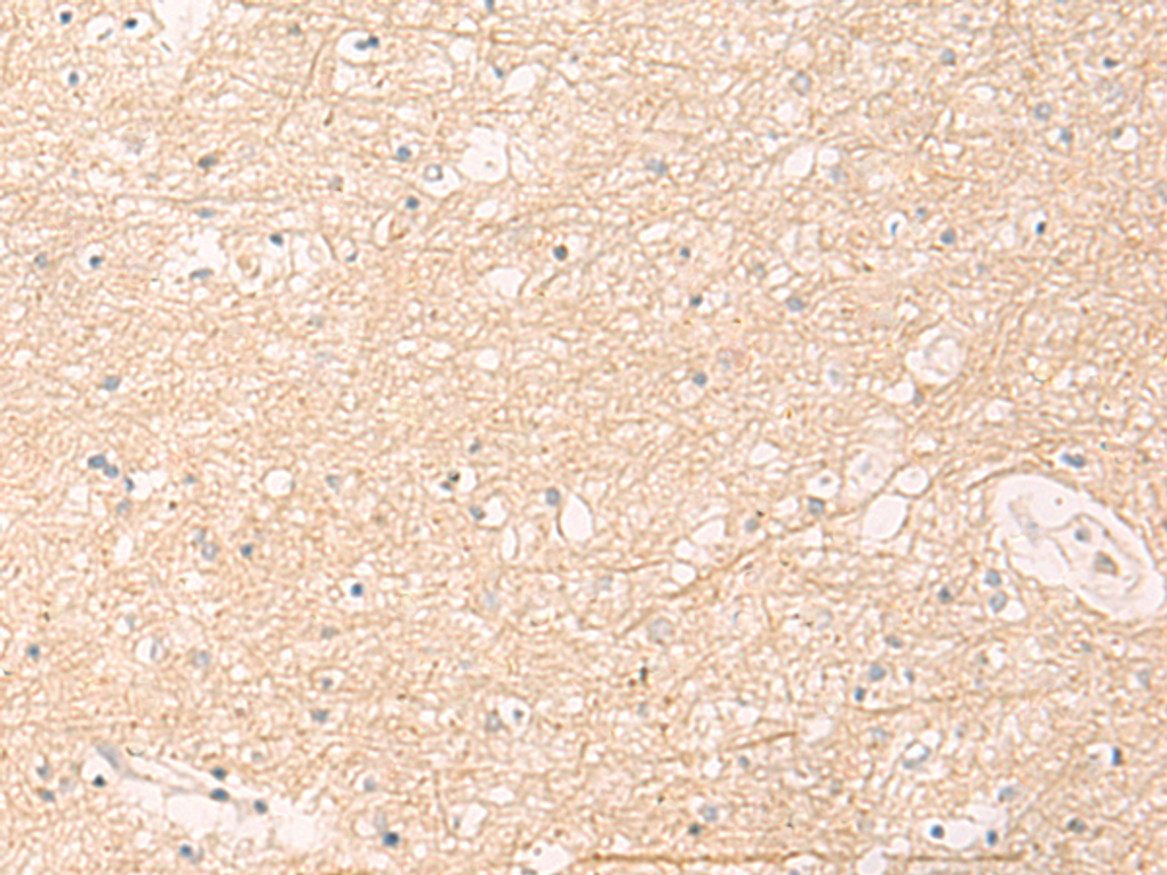 Immunohistochemistry of paraffin-embedded Human brain tissue  using ELP1 Polyclonal Antibody at dilution of 1:30(×200)