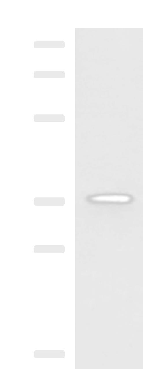 Western blot analysis of Mouse adrenal gland tissue lysate  using USP50 Polyclonal Antibody at dilution of 1:400