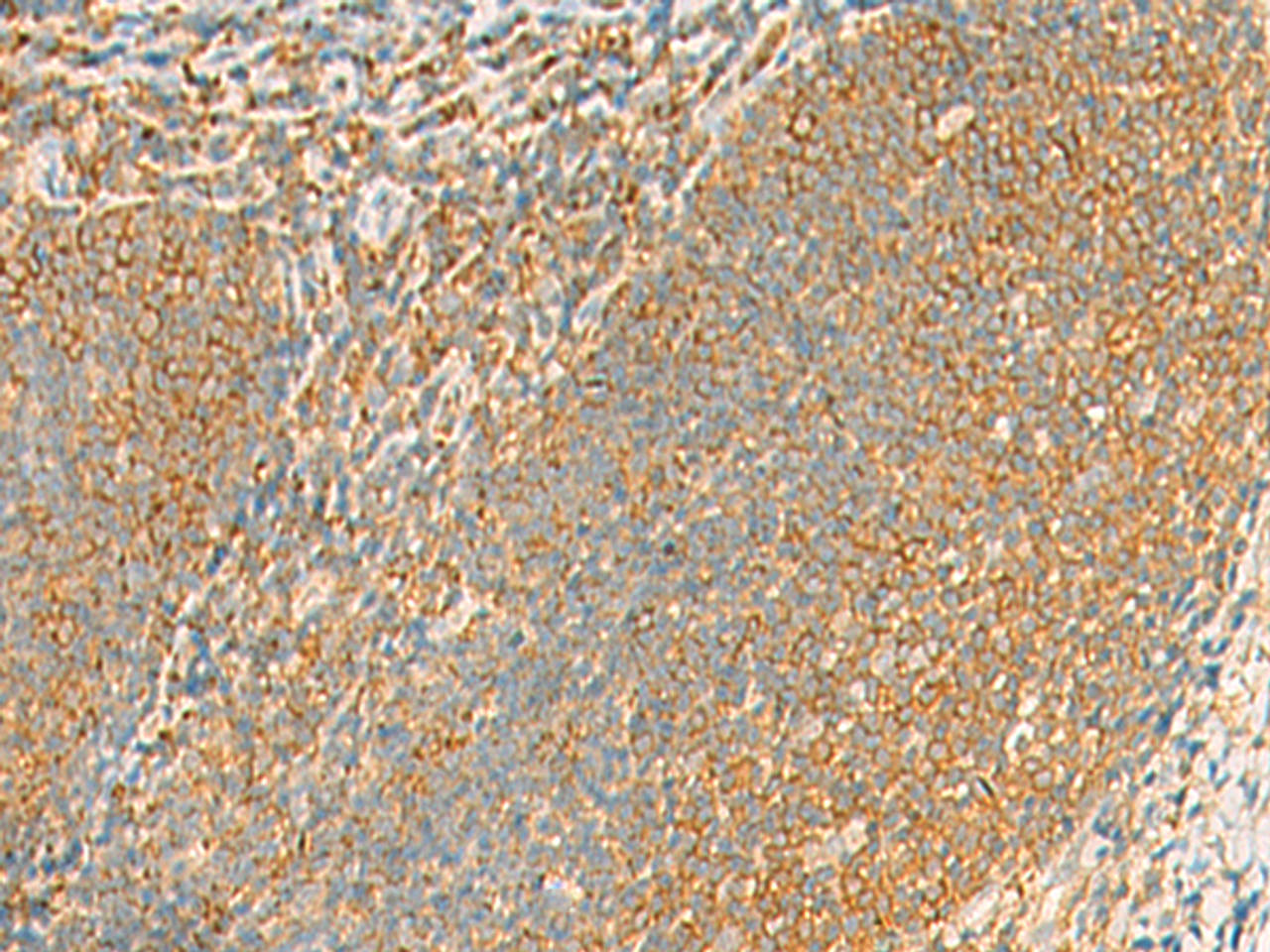 Immunohistochemistry of paraffin-embedded Human tonsil tissue  using GRIA4 Polyclonal Antibody at dilution of 1:60(×200)
