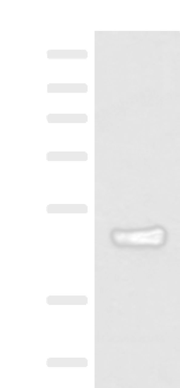 Western blot analysis of Mouse lung tissue lysate  using IRX5 Polyclonal Antibody at dilution of 1:300