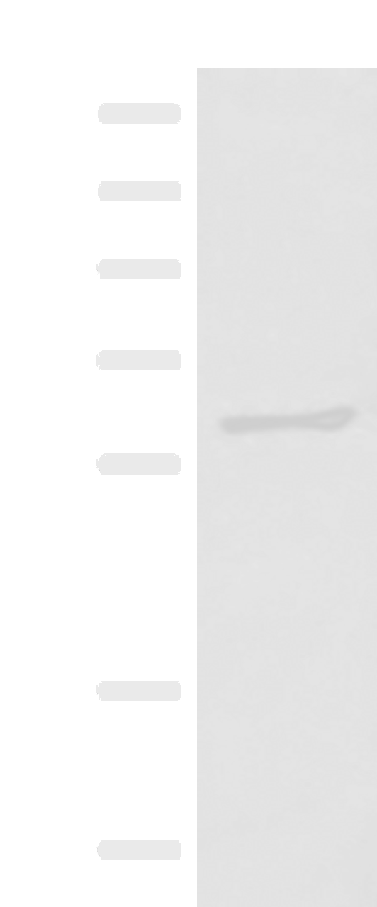 Western blot analysis of RAW264.7 cell lysate  using MBTPS2 Polyclonal Antibody at dilution of 1:800