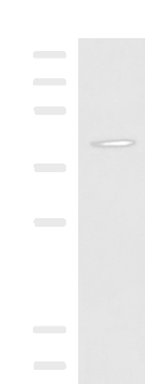 Western blot analysis of Mouse liver tissue lysate  using SPI1 Polyclonal Antibody at dilution of 1:1600
