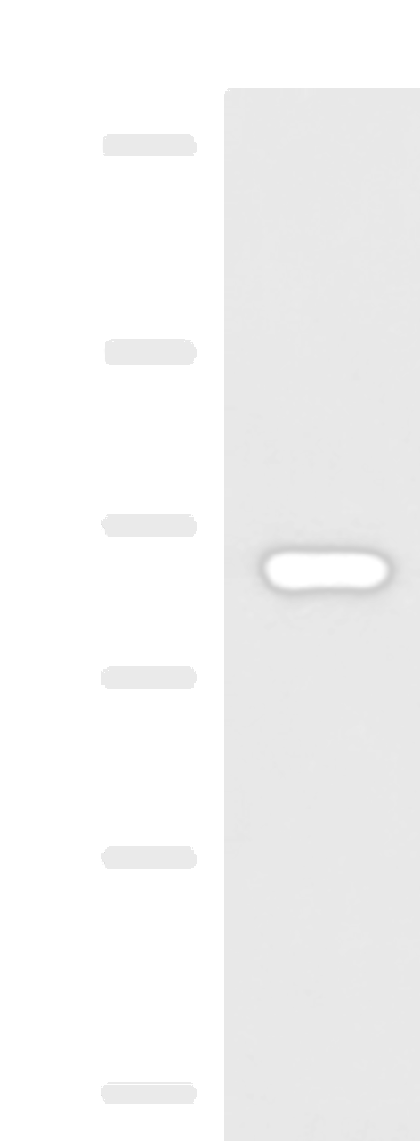 Western blot analysis of 293T cell lysate  using ABCB5 Polyclonal Antibody at dilution of 1:500