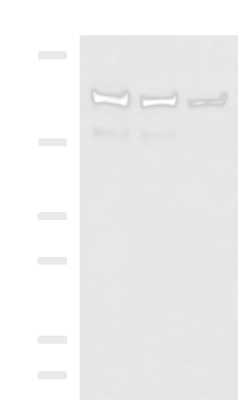 Western blot analysis of Mouse brain tissue Rat brain tissue and HepG2 cell lysates  using ROCK2 Polyclonal Antibody at dilution of 1:400