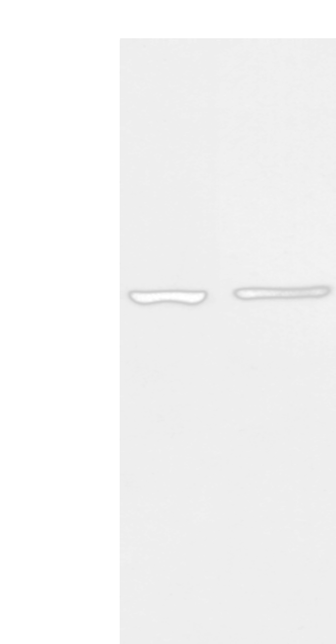 Western blot analysis of 293T cell and Human left kidney tissue  using AAK1 Polyclonal Antibody at dilution of 1:400