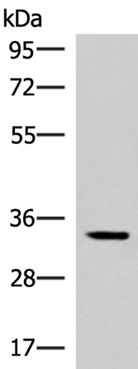 Western blot analysis of Mouse adrenal gland tissue lysate  using FOSL2 Polyclonal Antibody at dilution of 1:550