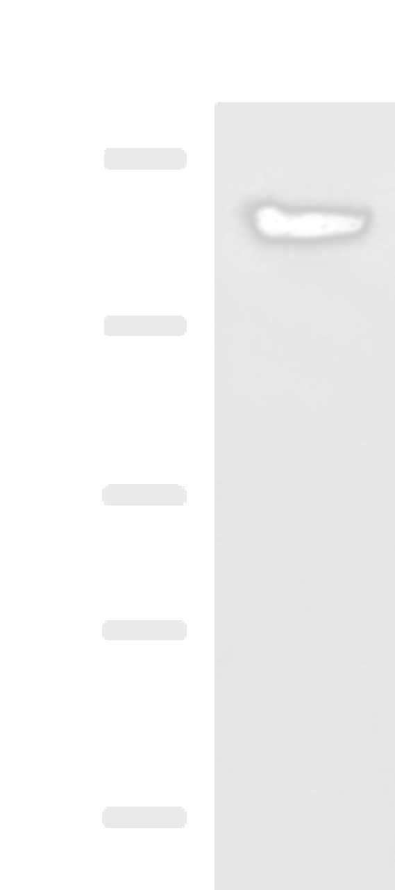 Western blot analysis of Mouse brain tissue lysate  using PDS5B Polyclonal Antibody at dilution of 1:800