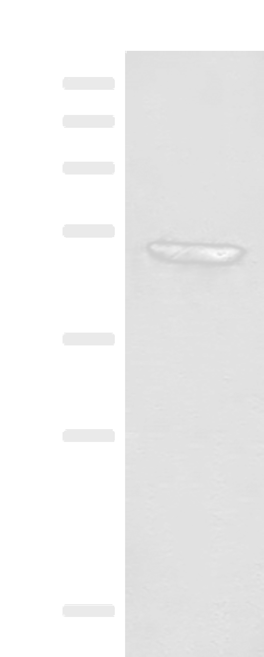 Western blot analysis of Mouse thymus tissue lysate  using FGL2 Polyclonal Antibody at dilution of 1:300