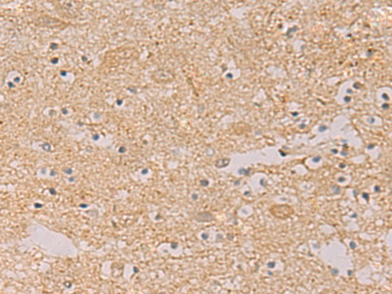 Immunohistochemistry of paraffin-embedded Human brain tissue  using PTPRN Polyclonal Antibody at dilution of 1:55(×200)