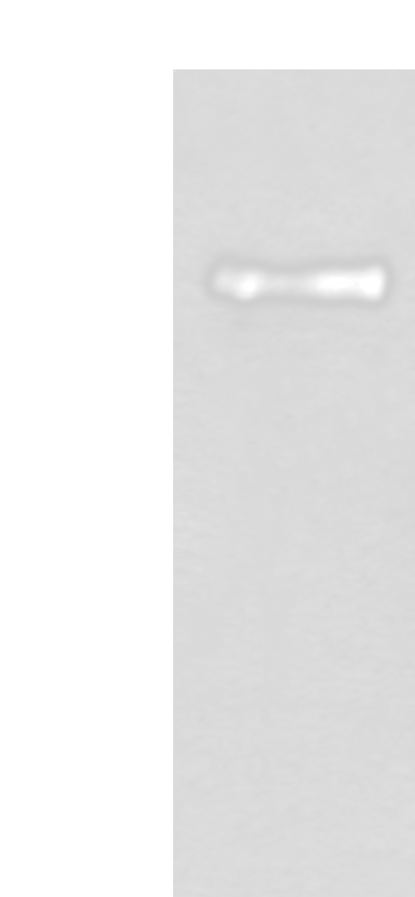 Western blot analysis of Mouse brain tissue lysate  using PTPRA Polyclonal Antibody at dilution of 1:400