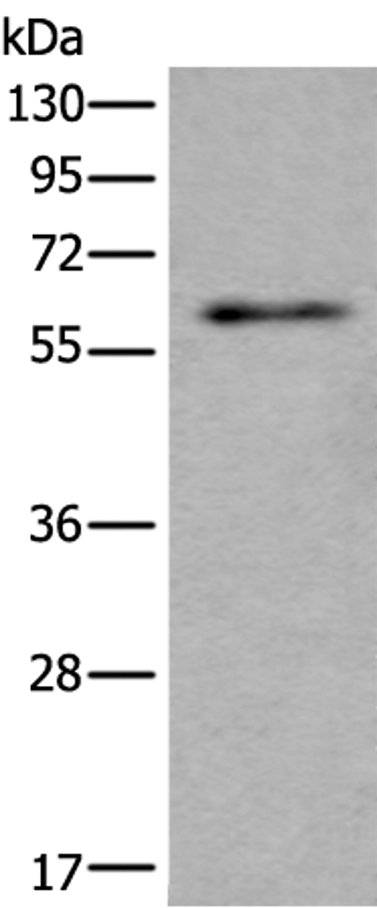 Western blot analysis of Mouse testis tissue lysate  using SCP2 Polyclonal Antibody at dilution of 1:350