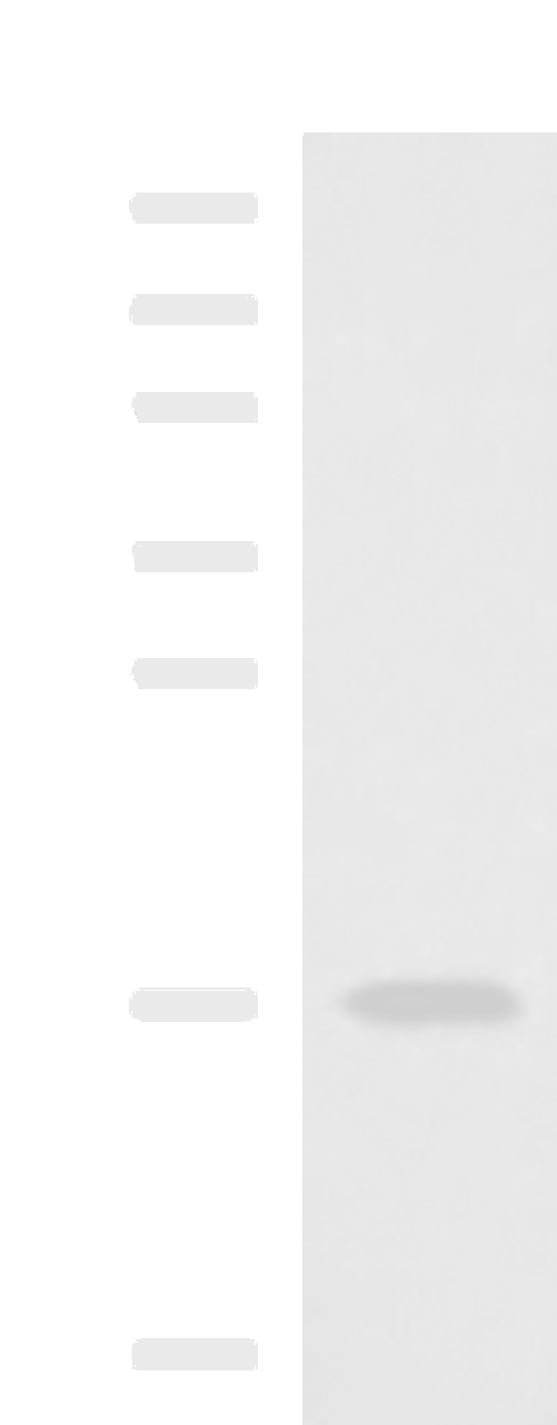 Western blot analysis of A375 cell lysate  using SRP14 Polyclonal Antibody at dilution of 1:1350