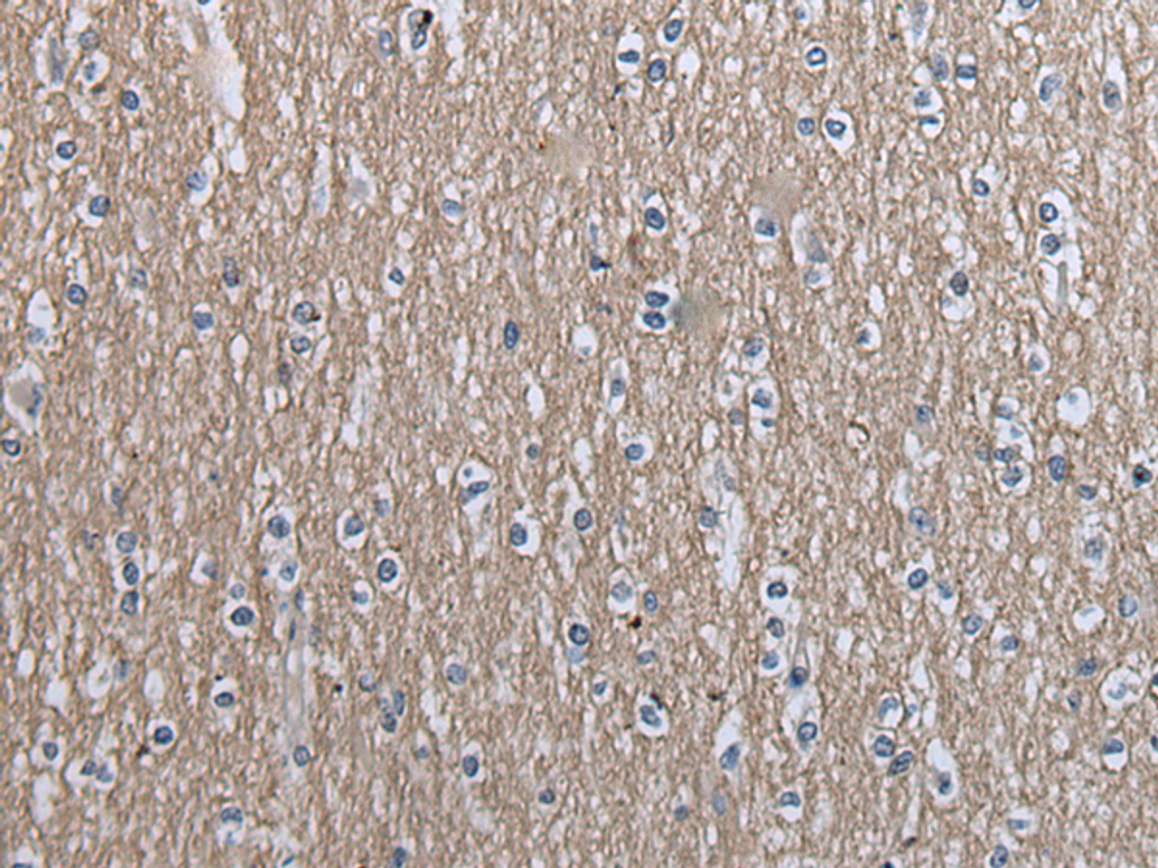 Immunohistochemistry of paraffin-embedded Human brain tissue  using SLC39A14 Polyclonal Antibody at dilution of 1:40(×200)