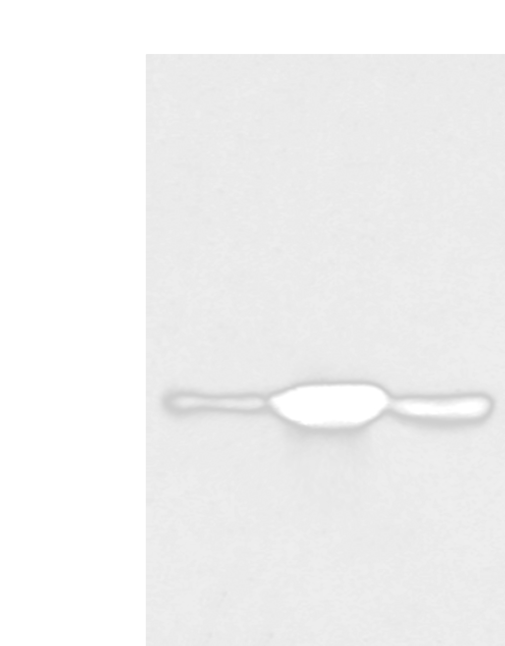 Western blot analysis of K562 A375 and 231 cell  using SPRY4 Polyclonal Antibody at dilution of 1:400