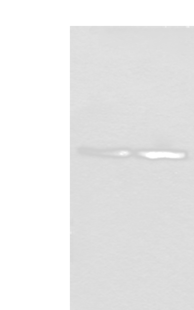 Western blot analysis of Jurkat and PC-3 cell lysates  using WDR18 Polyclonal Antibody at dilution of 1:400